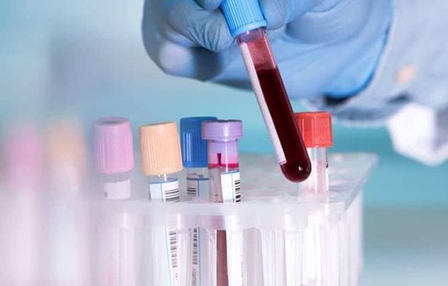 Chẩn đoán xác định Lupus sơ sinh dựa trên các triệu chứng lâm sàng của trẻ