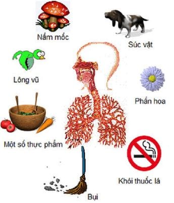 Yếu tố vi khuẩn, nấm mốc, khói bụi... là một trong những nguyên nhân gây nên bệnh hen suyễn.