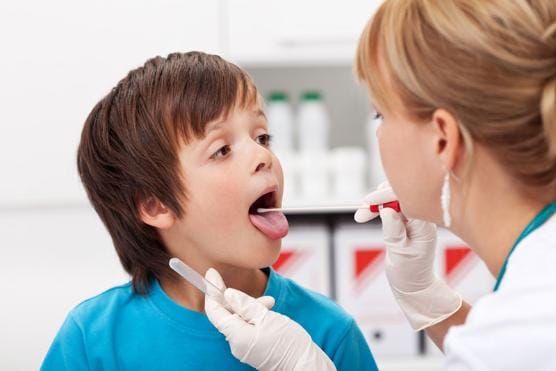 Viêm họng cấp thường do virus vi khuẩn gây ra