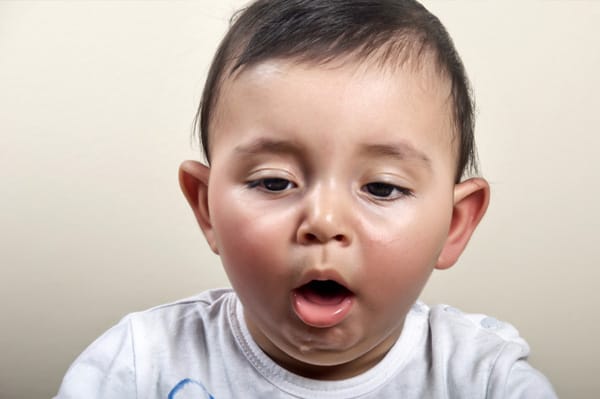 Trẻ nhiễm RSV có thể ho sau chuyển khò khè, thậm chí có thể có cơn ngưng thở khi bệnh chuyển nặng.