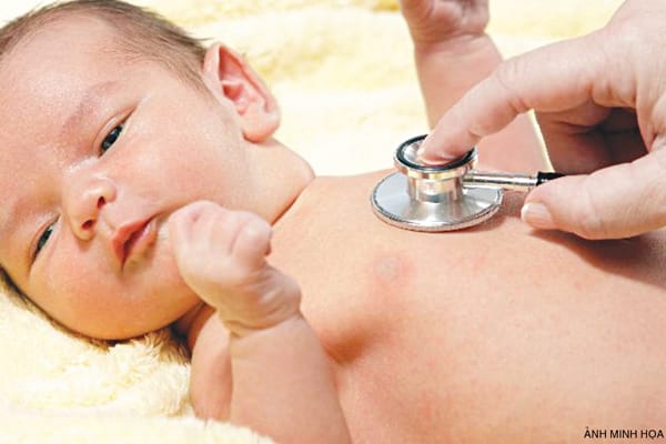 Bệnh tim bẩm sinh chiếm 54% tổng số bệnh tim ở trẻ em.