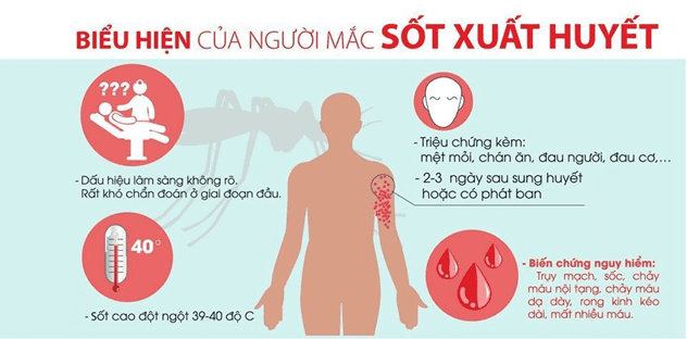 Các dấu hiệu và triệu chứng của sốt xuất huyết có thể bị nhầm lẫn với sốt rét, thương hàn, phát ban.