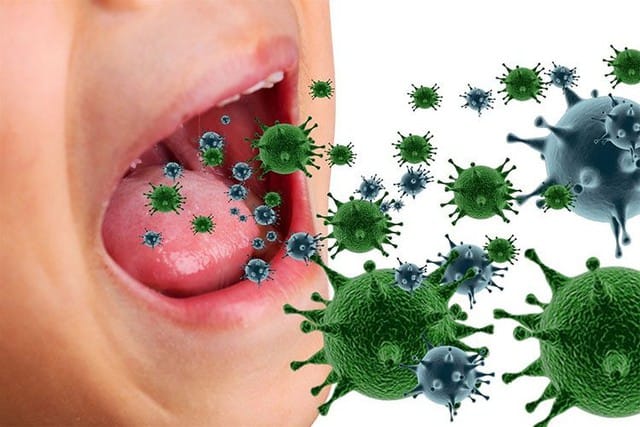 Có nhiều nguyên nhân dẫn đến tình trạng viêm mũi họng ở trẻ sơ sinh, trong đó có virus, vi khuẩn.