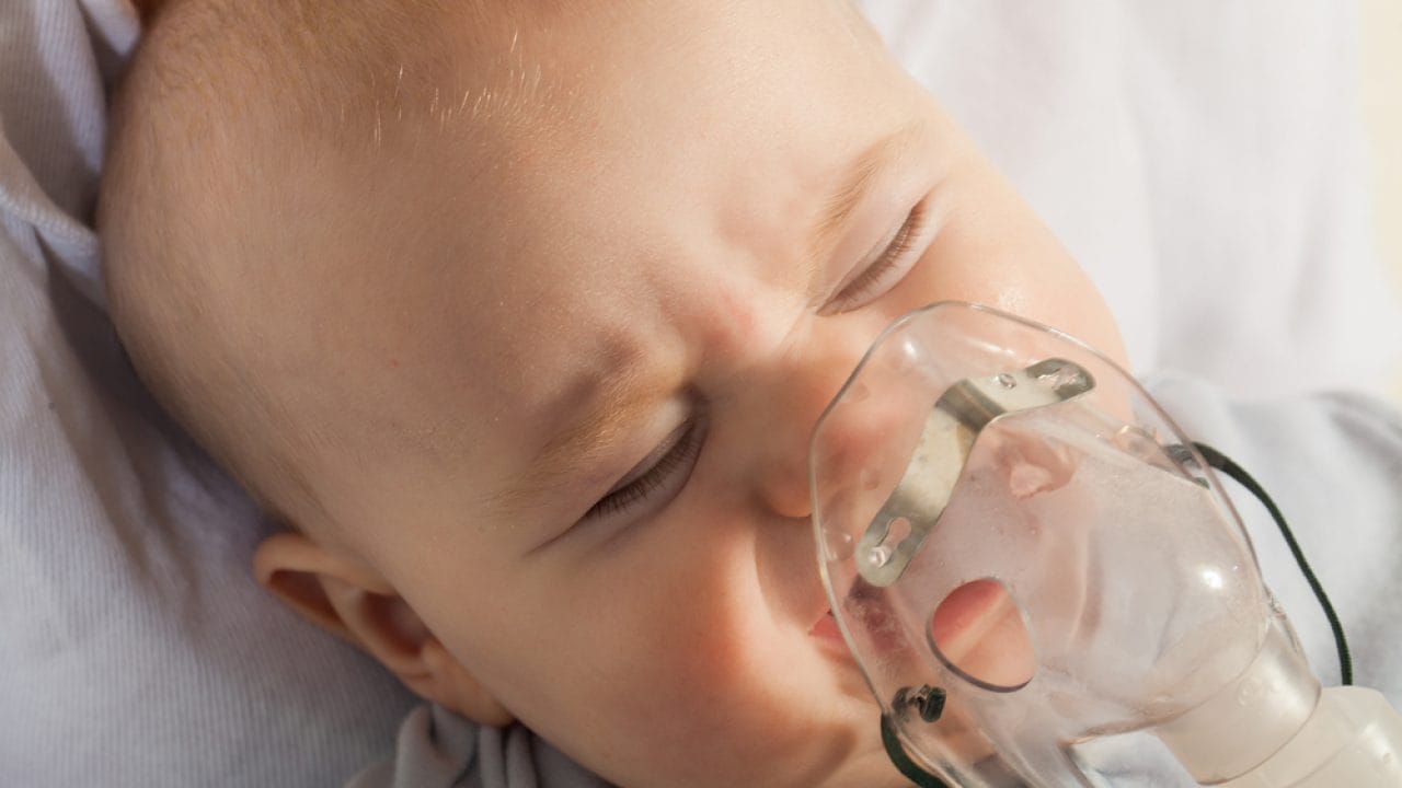 Trẻ bị viêm tiểu phế quản cấp có thể phải hỗ trợ thở oxy.