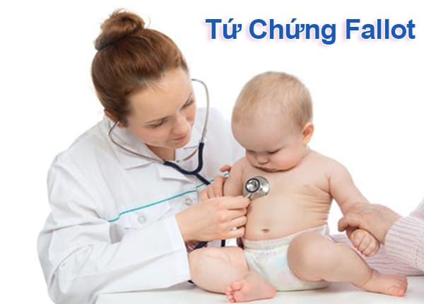 Tứ chứng Fallot thường có tiên lượng xấu nếu không được phẫu thuật sớm.