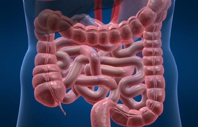 Hội chứng ruột ngắn ở trẻ do nhiều nguyên nhân, trong đó chủ yếu là nguyên nhân sau khi phẫu thuật cắt ruột.