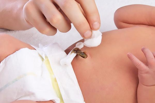 Rốn trẻ sơ sinh cần chăm sóc tốt, đảm bảo các hốc rốn khô và dây rốn rụng tự nhiên.