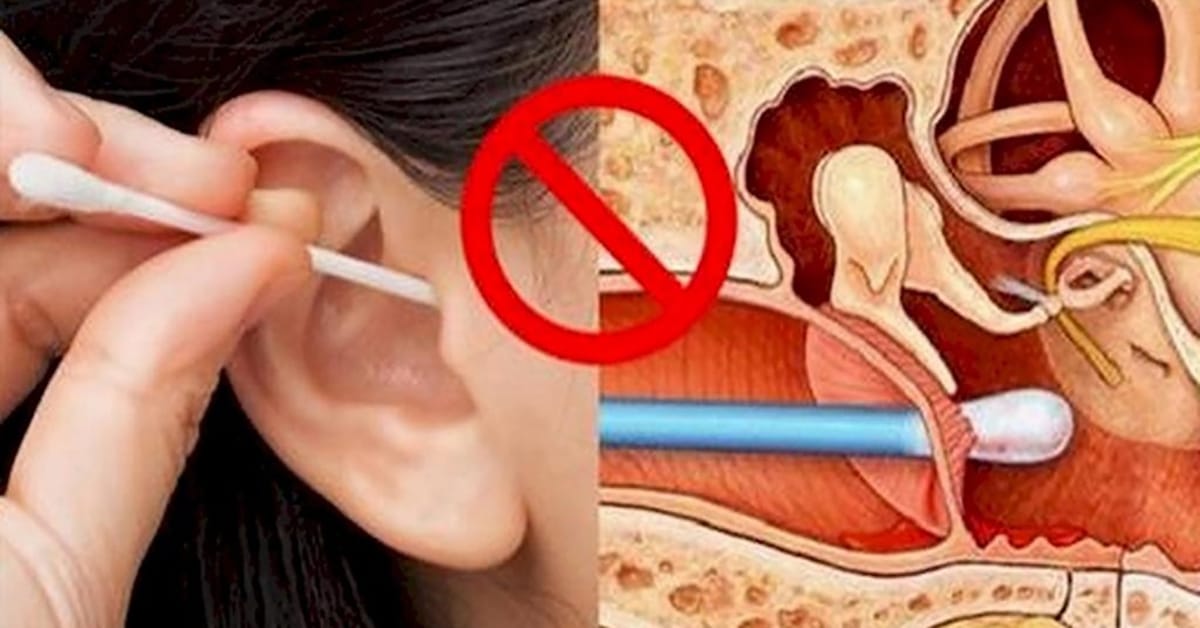 Khi vệ sinh tai cho trẻ bằng tăm bông hoặc vật dụng lấy ráy tai nếu không cẩn thận cũng có thể vô tình khiến cho trẻ bị thủng màng nhĩ.