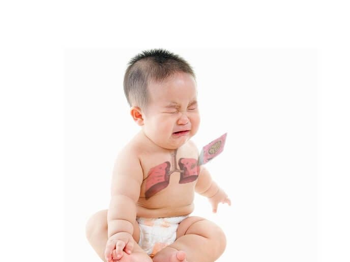 Viêm phổi là tình trạng viêm của nhu mô phổi. Ảnh minh hoạ