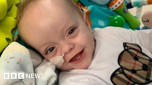 Trẻ mắc NPD tuýp A