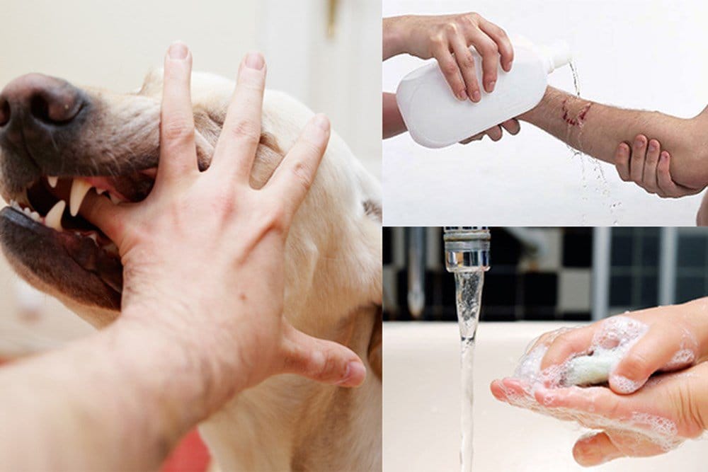 Xả nước rửa kỹ tất cả các vết cắn/cào trong 15 phút với nước và xà phòng, hoặc nước sạch ngay sau khi bị cắn.