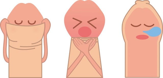 Không phải trường hợp nào trẻ bị hẹp bao quy đầu cũng được chỉ định cắt bao quy đầu.