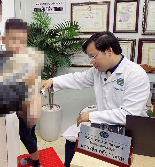 BSCKII. Nguyễn Tiến Thành thăm khám sùi mào gà cho bệnh nhi.