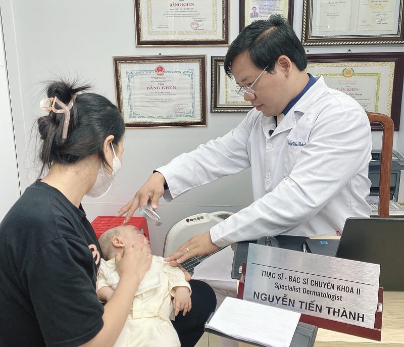 BSCKII Nguyễn Tiến Thành - thành viên Hội Da liễu Việt Nam thăm khám cho bệnh nhi.