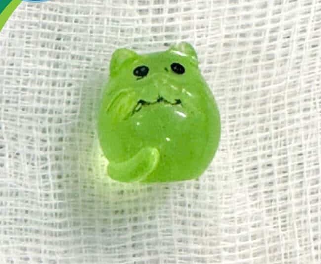 Dị vật được gắp ra từ 