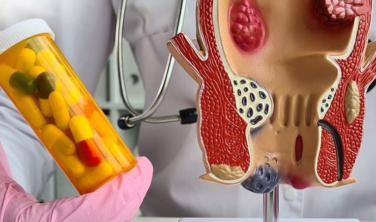 Đa phần trẻ gặp phải dị tật về hậu môn trực tràng đều cần được phẫu thuật để điều trị.