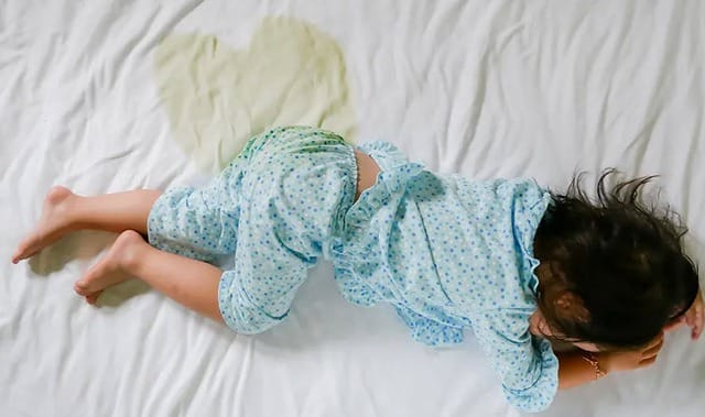 Tiểu không tự chủ ở trẻ em gây ảnh hưởng lớn đến tâm lý và sinh hoạt.