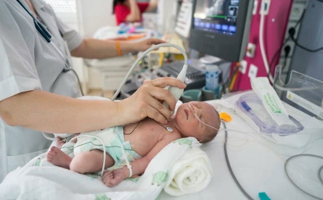 Trẻ sơ sinh bị tim bẩm sinh được chăm sóc đặc biệt ngay sau sinh, giúp tăng cơ hội sống sót và phát triển bình thường. Ảnh minh họa