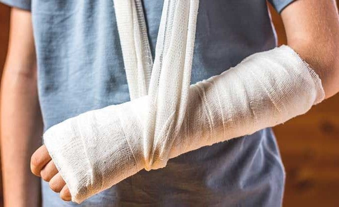 Kỳ nghỉ hè là thời điểm trẻ dễ gặp tai nạn khi vui chơi, trong đó gãy xương là một trong những chấn thương thường gặp.