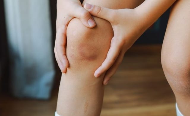 Trẻ bị viêm khớp hoặc bệnh lý cơ xương thường có thêm các dấu hiệu như sưng khớp, cứng khớp buổi sáng hoặc đi khập khiễng.