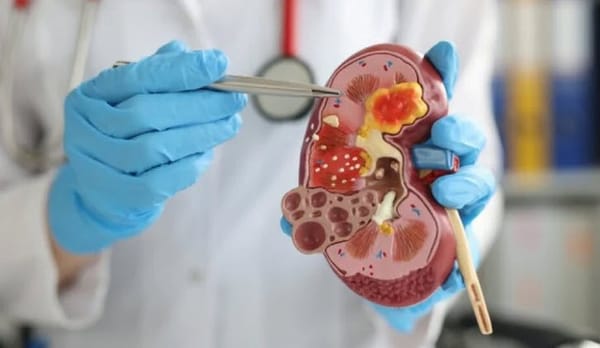 Trẻ em đối mặt biến chứng nguy hiểm từ thận hư kháng thuốc