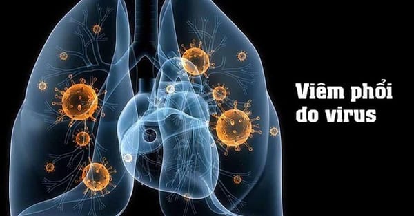 Viêm phổi do virus ở trẻ em: Triệu chứng, điều trị và cách chăm sóc, phòng ngừa