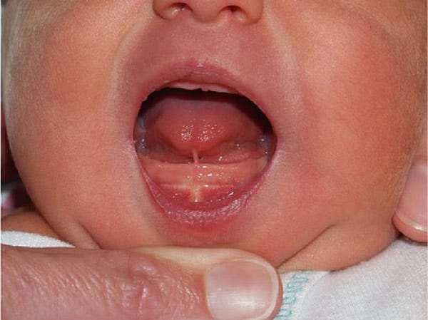 Những nguyên nhân khiến trẻ chậm nói cha mẹ cần biết