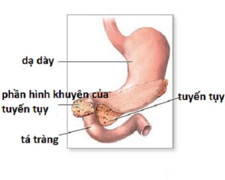 Cha mẹ cần cảnh giác với tắc tá tràng bẩm sinh ở trẻ