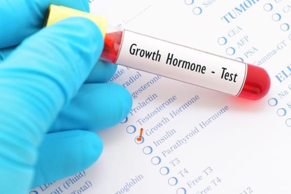 Trẻ thấp lùn do thiếu hụt hormone tăng trưởng