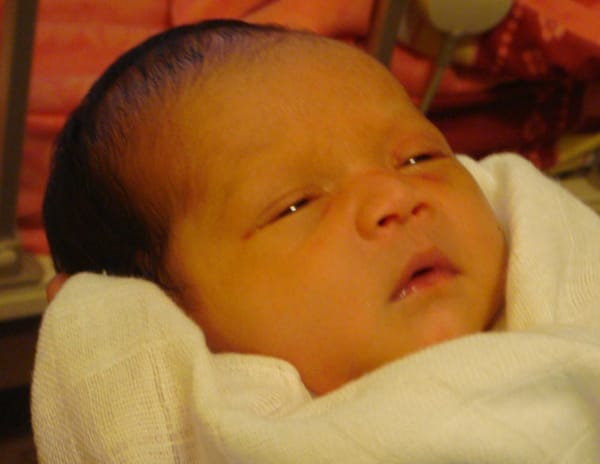 Thiếu men G6PD ở trẻ cần lưu ý những gì?