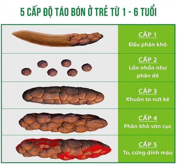 Các lưu ý chăm sóc trẻ bị táo bón cha mẹ nên đọc