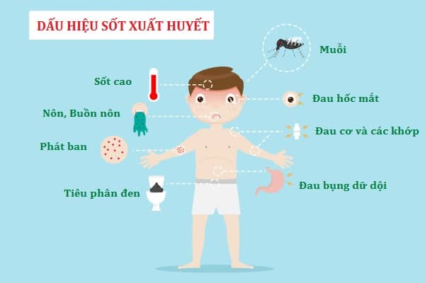 Dấu hiệu chứng tỏ trẻ sốc sốt xuất huyết và cách xử trí đúng