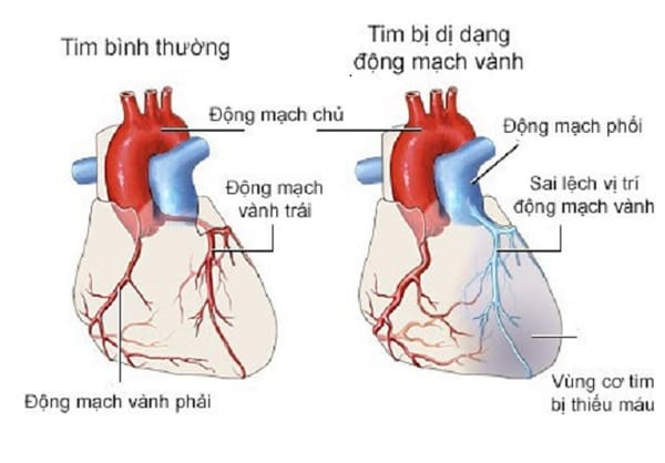 Tim đập nhanh, mệt, thở khó... cảnh giác với bệnh trọng cần nhập viện ngay