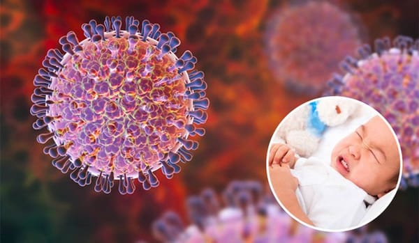 Lưu ý khi chăm sóc trẻ bị tiêu chảy do Rotavirus