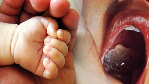 Bệnh nhân 15 tuổi dương tính với bệnh bạch hầu đã tử vong, cần phòng bệnh đúng cách