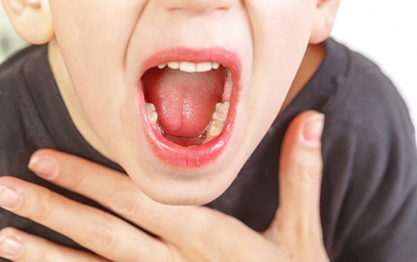 Viêm amidan quá phát trong mùa hè ở trẻ phải làm gì?