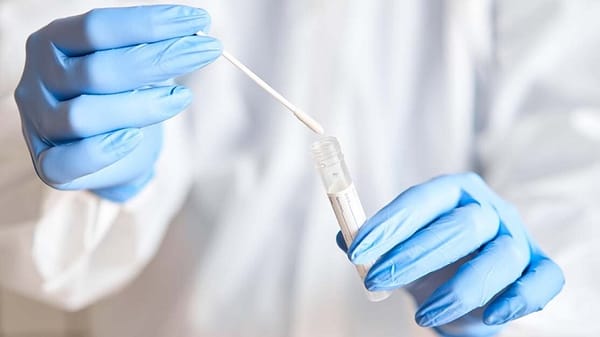 Các phương pháp xét nghiệm chẩn đoán bệnh cúm