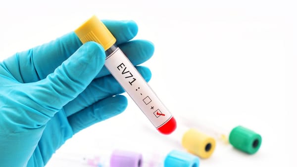 Thời gian lây bệnh tay chân miệng kéo dài bao lâu?