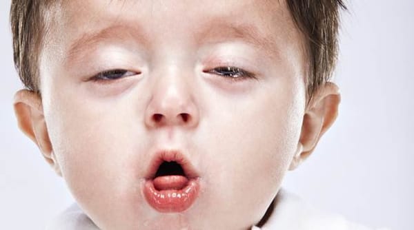Cách phân biệt trẻ ho gà với ho thông thường