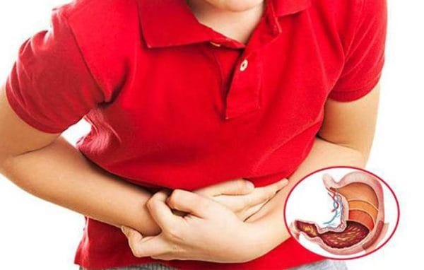 Trẻ nhiễm H. Pylori cần tuân thủ điều trị để tránh biến chứng