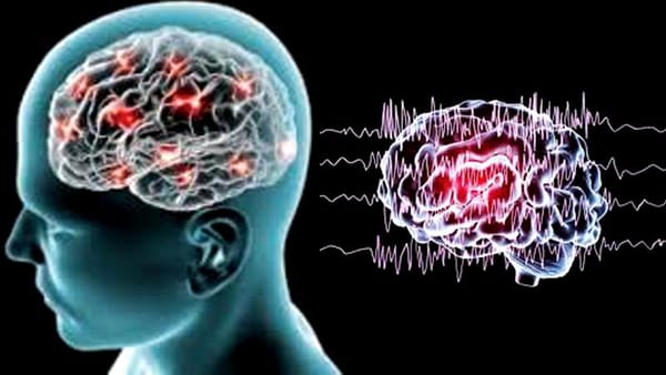 Động kinh ở trẻ em có chữa khỏi được không?